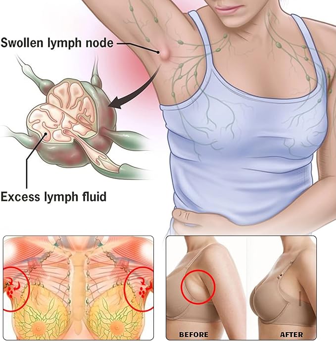 BXQJRJLymphatic Drainage Patch Lymphatic Drainage Herbal Lymphatic Drainage Care Patch Herbal Neck Patch (12)